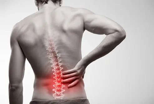 Complete Guide to Low Back Pain